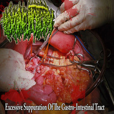 Excessive Suppuration Of The Gastro-Intestinal Tract mp3 Album by Hydropneumothorax