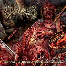 Uterovaginal Insertion Of Extirpated Anomalies mp3 Album by Cephalotripsy