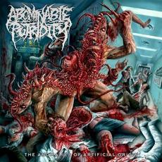 The Anomalies of Artificial Origin (Remastered) mp3 Album by Abominable Putridity