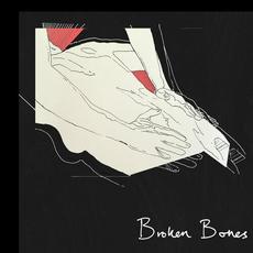 Broken Bones mp3 Single by Tors