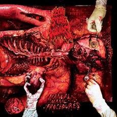 Manual Manic Procedures mp3 Album by 200 Stab Wounds