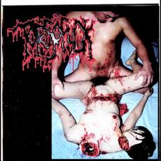 Disgusting Gore And Pathology / Polymorphisms To Severe Sepsis In Trauma mp3 Compilation by Various Artists