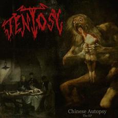 Chinese Autopsy: The EP mp3 Album by Tentosy