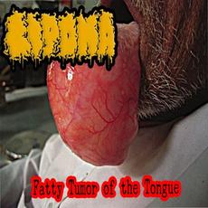 Fatty Tumor Of The Tongue mp3 Album by Lipoma