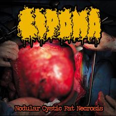 Nodular Cystic Fat Necrosis mp3 Album by Lipoma
