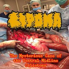 The Mysterious Case Of The Ventral Midline Celiotomy mp3 Album by Lipoma