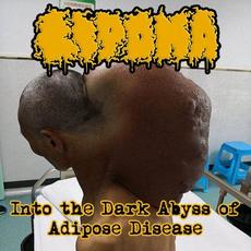Into The Dark Abyss Of Adipose Disease mp3 Album by Lipoma