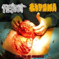 The Art Of Surgery mp3 Album by Lipoma