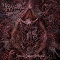 Aberrant Vaginal Gestation mp3 Album by Vulvectomy