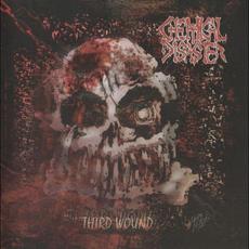 Third Wound mp3 Album by Chemical Disaster
