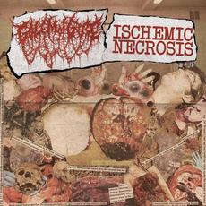 Ischemic Necrosis & Golem Of Gore mp3 Compilation by Various Artists