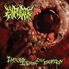 Infected Internal Cyst Eruption mp3 Album by Expurge
