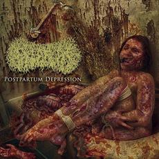 Postpartum Depression mp3 Album by Paediatrician