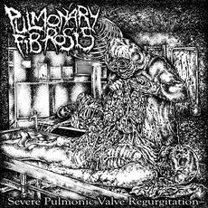 Severe Pulmonic Valve Regurgitation mp3 Album by Pulmonary Fibrosis