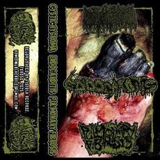 Cystic Hygroma & Endocarditis & Pulmonary Fibrosis mp3 Album by Pulmonary Fibrosis