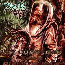 $15 Lobotomy mp3 Single by Acephalia