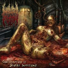 Concatenation of Severe Infections mp3 Album by Infected Flesh
