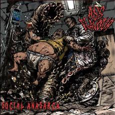 Social Anasarca mp3 Album by Ass Flavour