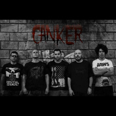 Canker Music Discography