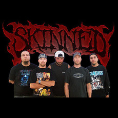 Skinned Music Discography